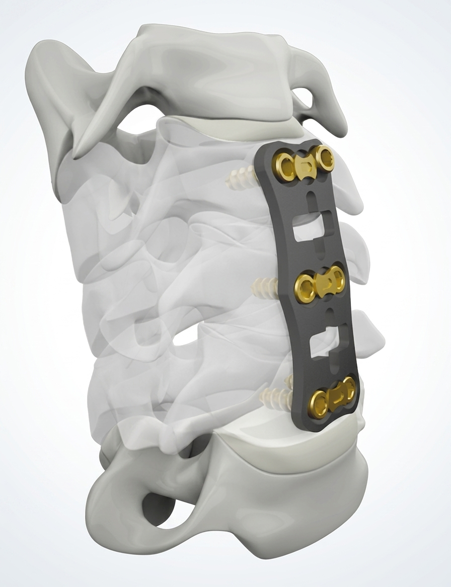 Anterior Cervical Plate 