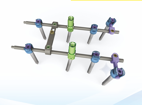  Saturn Pedicle Screw System